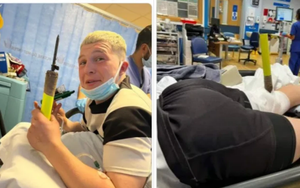 Kinh dị VĐV bị cột cờ đâm thủng đầu gối, nhưng thần thái tưng tửng của anh chàng còn đáng chú ý hơn