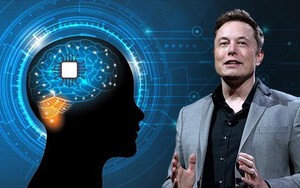 Căn bệnh kinh niên cả thế giới không ai trị được, Elon Musk nói cấy chip Neuralink vào não chắc chắn khỏi