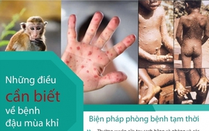 Những điều cần biết về bệnh đậu mùa khỉ