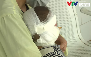Cảnh báo: Gia tăng trẻ nhỏ bị bỏng nhiệt