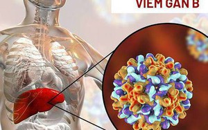 Nhiễm virus viêm gan B sau bao lâu thì xuất hiện triệu chứng và tiến triển thành ung thư gan?