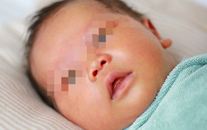 Viêm gan bí ẩn ở trẻ em khiến nhiều bố mẹ hoang mang: Bác sĩ gan mật giải thích cặn kẽ