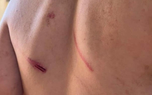 Cháu bé 9 tuổi bị bà và cha đánh đập dã man