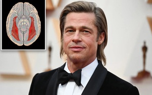 Chứng "mù mặt" Brad Pitt mắc phải - Tất cả những điều bạn muốn biết!