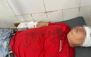 Một người bị chém gần đứt lìa cánh tay ở TP Thủ Đức