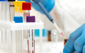 Thêm nước Đông Nam Á có đậu mùa khỉ, WHO nghi Ebola tái xuất