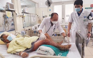 Loại vi khuẩn nguy hiểm khiến người đàn ông hoại tử chân, nhiễm khuẩn huyết nặng
