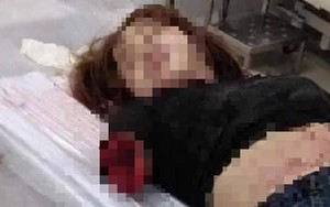 Lời khai ban đầu của người chồng chém lìa 2 cánh tay vợ