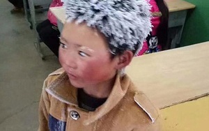 "Cậu bé đóng băng" hiện giờ thế nào?