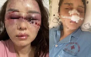 Kết quả điều tra cán bộ QLTT đánh bạn gái dã man vì hát song ca với người khác