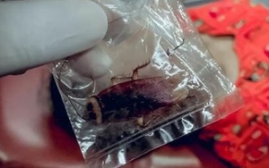 Người phụ nữ phải nhập viện cấp cứu vì bị gián cắn lúc đang ngủ
