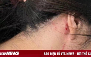 Từ chối đi xem mắt, cô gái Trung Quốc bị đánh đập