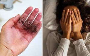 Chuyên gia cảnh báo thói quen làm tăng nguy cơ rụng tóc, khiến vi khuẩn phát triển