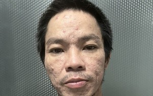 Phá đường dây ma túy của đại ca Hải “mặt rỗ”