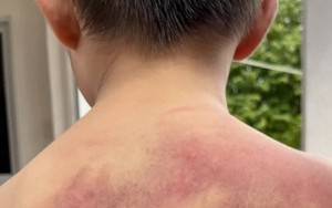 Khởi tố người đàn ông bạo hành con ruột tàn nhẫn