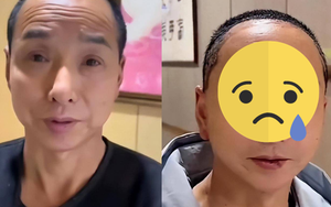 Người đàn ông “lột xác” sau phẫu thuật thẩm mỹ: Nhìn trẻ ra 30 tuổi nhưng ai cũng sợ khi thấy thứ này