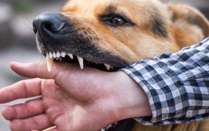 Điều tra nguyên nhân nữ công nhân tử vong nghi bị chó tấn công