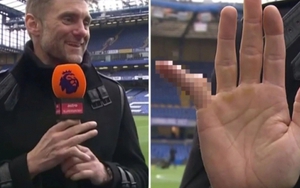 Sau khi chơi gần 700 trận, cựu thủ môn gây ngỡ ngàng khi tiết lộ hình ảnh ngón tay út