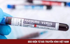 WHO họp khẩn vì ổ dịch sốt xuất huyết do virus Marburg