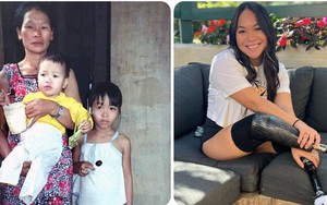 Cuộc sống hiện tại của bé gái gốc Việt bị bố mẹ nổ bom mất 2 chân: Được báo chí thế giới gọi là 'nữ kình ngư thần kỳ', trở thành đại sứ truyền cảm hứng cho những người khuyết tật