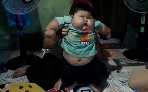Cuộc sống của cậu bé "khổng lồ"16 tháng tuổi đã nặng 27kg, không thể tự đứng thẳng hay bước đi, mặc đồ của bố mới vừa