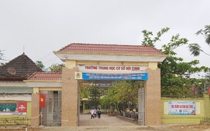 Bị bạn đấm vào đầu, nam sinh chấn thương sọ não