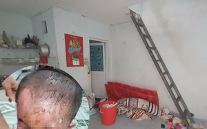 Vụ bé trai nghi bị cha mẹ đánh đập dã man: Người thân cung cấp thông tin bất ngờ