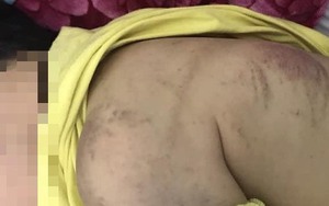 Xác minh thông tin bé trai 8 tuổi bị mẹ đẻ bạo hành vì chưa làm bài tập