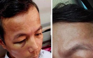 Vụ hiệu trưởng đánh hiệu phó nhập viện ở Quảng Bình: Cả hai cùng bị phạt tiền