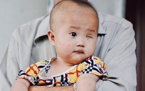 Lời khẩn cầu của ông nội xin cứu bé gái 14 tháng tuổi phải bỏ một bên mắt vì ung thư