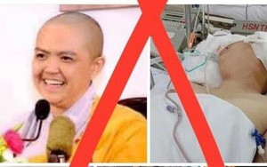 Thực hư thông tin nhiều bài viết chạy quảng cáo kêu gọi ủng hộ một "ni sư bị tai biến"