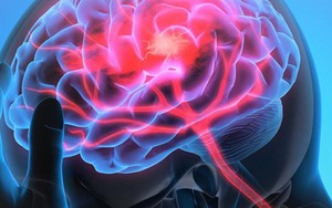 Nghiên cứu khoa học chỉ ra ‘thủ phạm’ hàng đầu của loại đột quỵ đang gia tăng ở người trẻ