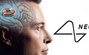 Công ty Neuralink của Elon Musk được phép thử nghiệm cấy chip vào não người