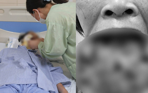 Ăn thực dưỡng tự điều trị bệnh, người phụ nữ mang khối u môi dưới lở loét với kích thước khủng