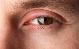 Đôi mắt nói gì về sức khỏe của bạn?