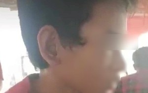 Xác minh vụ thiếu niên 14 tuổi bị cha dượng hành hạ, đốt ‘vùng kín’