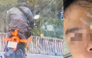 Nam thanh niên tố bị thương sau khi va vào gậy CSGT: Lãnh đạo PC08 TP.HCM lên tiếng