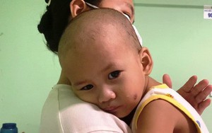 Người mẹ trẻ mong sự giúp đỡ để con thơ được ghép tủy