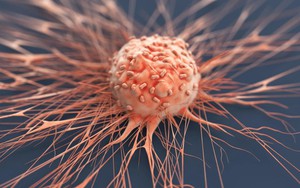 6 điều khiến khối u "khiếp sợ", làm đủ chẳng lo ung thư "ghé thăm"