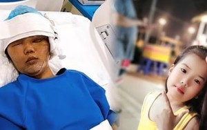 Mẹ đơn thân bị khối u nửa mặt và hành trình 'lột xác' sau 3 cuộc đại phẫu