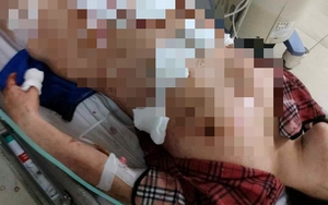 Phẫn nộ người vợ bị chồng chích điện và dùng dao đâm vào người