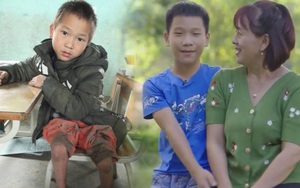 Bất ngờ hình ảnh cậu bé liệt 2 chân Lù Văn Chiến sau 5 năm: Chững chạc, biết chơi đàn, mơ làm bác sĩ