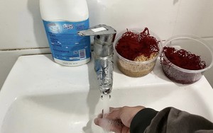 Bệnh nhân Bệnh viện Y học cổ truyền Trung ương phản ánh không đủ nước nóng sinh hoạt