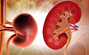 Huyết áp tăng vọt, người đàn ông Hà Nội đi khám, phát hiện bị suy thận: Hối hận vì không sớm làm điều này
