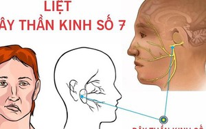 Căn bệnh khiến ca sĩ Nguyễn Trần Trung Quân vào bệnh viện cấp cứu