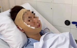 Nữ TikToker nổi tiếng đưa ra lời cảnh báo sau 6 năm "tiêm filler"