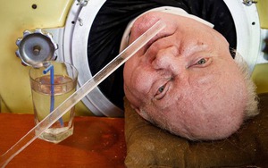 Người đàn ông 70 năm sống trong "lá phổi sắt" qua đời ở tuổi 78