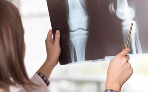 Cô gái mắc ung thư ở tuổi 15: 'Kỹ thuật viên đã khóc khi chụp X quang cho tôi'