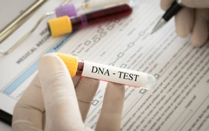Đưa 3 con đi xét nghiệm ADN, người đàn ông nhận kết quả ngang trái, có liên quan tới anh trai