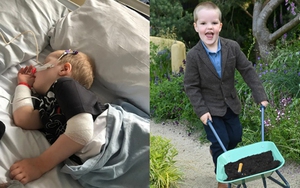 Bé trai 4 tuổi bị đột quỵ sau gần 1 năm mắc thủy đậu, hãy cẩn thận biến chứng nguy hiểm của bệnh này